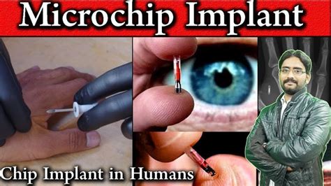 rfid chips australian citizens|microchips for people.